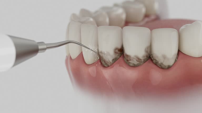 Trusted Dental Implants service in Crandon Lakes, NJ - Dentist Open Now
